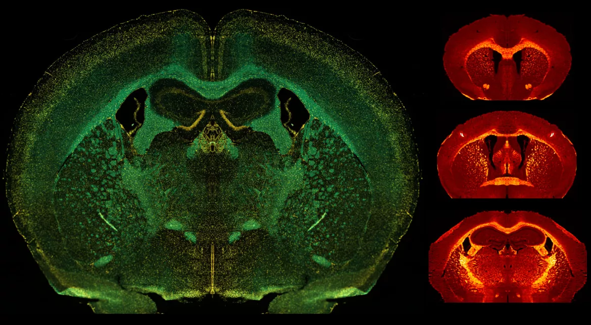 digital microscope image of brain